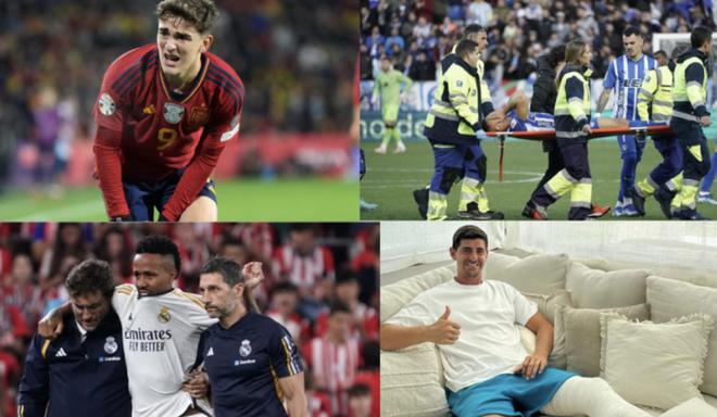 意大利客场, 改进 意大利客场, 改进